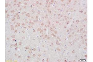 Formalin-fixed and paraffin embedded rat brain tissue labeled with Anti- TPH (Ser19) Polyclonal Antibody, Unconjugated(ABIN2179763) 1:200 followed by conjugation to the secondary antibody and DAB staining (Tryptophan Hydroxylase 2 antibody  (pSer19))