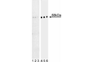 Western blot analysis of BLNK (pY84) in human Burkitt’s lymphoma. (B-Cell Linker antibody  (pTyr84))