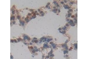 #VALUE! (PD-1 antibody  (AA 39-266))