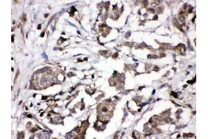 IHC analysis of PKC alpha using anti-PKC alpha antibody (ABIN3043549). (PKC alpha antibody  (AA 153-342))
