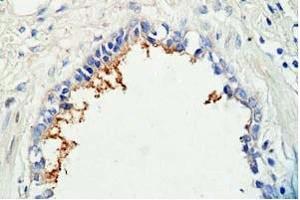 Human lung tissue was staned by Rabbit Anti-AdrenomeduIIiln (1-44) (Human) Antibody (Adrenomedullin antibody  (AA 1-44))