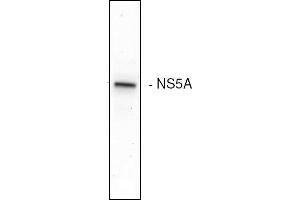 Western blot analysis of the HCV NS5A expression in Huh7 cells (Hepatitis C Virus antibody)
