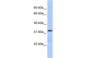 Western Blotting (WB) image for anti-Sprouty Homolog 3 (SPRY3) antibody (ABIN2463341) (SPRY3 antibody)