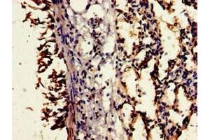 Immunohistochemistry of paraffin-embedded human lung tissue using ABIN7148376 at dilution of 1:100 (CD55 antibody  (AA 35-126))