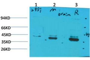 Western Blot (WB) analysis of 1)293T, 2)Mouse Brain Tissue, 3) Rat Brain Tissue with CABP2 Rabbit Polyclonal Antibody diluted at 1:2000.