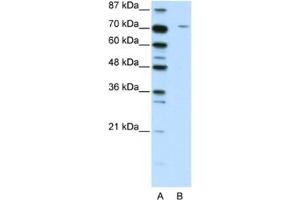 Western Blotting (WB) image for anti-Leucine Zipper, Putative Tumor Suppressor 1 (LZTS1) antibody (ABIN2461908)