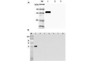 Western blot analysis of human ANGPTL4 using anti-ANGPTL4 at 1:2,000 dilution.