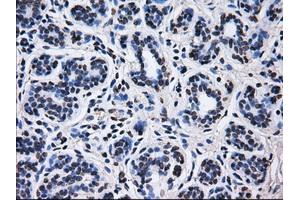 Immunohistochemical staining of paraffin-embedded breast tissue using anti-RPA2 mouse monoclonal antibody.