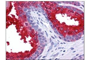 Human Prostate: Formalin-Fixed, Paraffin-Embedded (FFPE) (SCUBE2 antibody)
