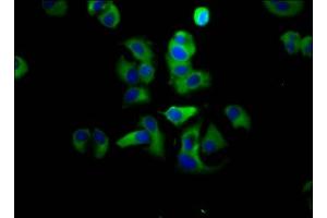 Immunofluorescence staining of MCF-7 cells with ABIN7143399 at 1:133, counter-stained with DAPI. (Adhesion G Protein-Coupled Receptor G1 (ADGRG1) (AA 26-216) antibody)