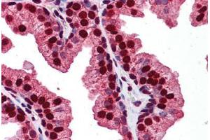 Human Prostate: Formalin-Fixed, Paraffin-Embedded (FFPE) (RAB23 antibody  (C-Term))