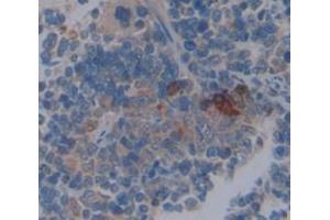 Used in DAB staining on fromalin fixed paraffin- embedded spleen tissue (Coronin 1a antibody  (AA 1-204))