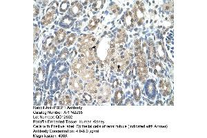 Rabbit Anti-PBEF1 Antibody  Paraffin Embedded Tissue: Human Kidney Cellular Data: Epithelial cells of renal tubule Antibody Concentration: 4.