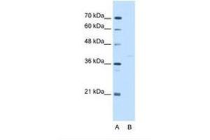 Image no. 2 for anti-GDP-Mannose Pyrophosphorylase B (GMPPB) (C-Term) antibody (ABIN321530) (GMPPB antibody  (C-Term))