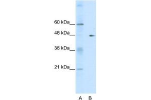 WB Suggested Anti-GDI2 Antibody Titration:  0. (GDI2 antibody  (C-Term))