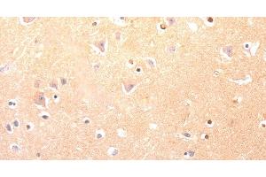 Immunohistochemistry of paraffin-embedded Human brain using CAPNS1 Polyclonal Antibody at dilution of 1:60 (Calpain S1 antibody)