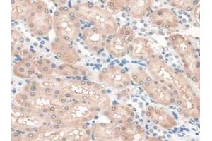 IHC-P analysis of Rat Kidney Tissue, with DAB staining. (GAMT antibody  (AA 2-236))