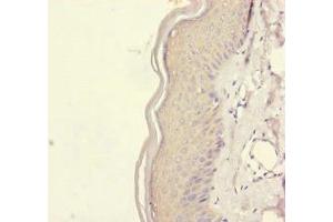 Immunohistochemistry of paraffin-embedded human skin tissue using ABIN7167451 at dilution of 1:100 (REEP5 antibody  (AA 120-189))
