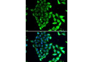 Immunofluorescence analysis of MCF-7 cells using MID1 antibody (ABIN6129304, ABIN6143835, ABIN6143836 and ABIN6223122). (MID1 antibody  (AA 478-667))