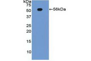 Detection of Recombinant ITGb2, Human using Polyclonal Antibody to Integrin Beta 2 (CD18) (Integrin beta 2 antibody  (AA 124-363))