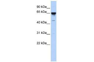 Western Blot showing ZNF587 antibody used at a concentration of 1-2 ug/ml to detect its target protein.