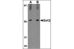 Western blot analysis of SIRT2 in Mouse brain lysate with AP30785PU-N SIRT2 antibody at (A) 1 and (B) 2 μg/ml. (SIRT2 antibody  (C-Term))