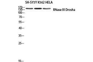Western Blot (WB) analysis of SH-SY5Y K562 HeLa using RNase III Drosha antibody. (DROSHA antibody)
