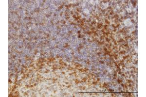 Immunoperoxidase of monoclonal antibody to SCAP1 on formalin-fixed paraffin-embedded human tonsil. (SKAP1 antibody  (AA 1-358))
