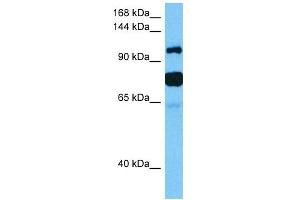 Host:  Mouse  Target Name:  HDAC4  Sample Tissue:  Mouse Testis  Antibody Dilution:  1ug/ml (HDAC4 antibody  (Middle Region))
