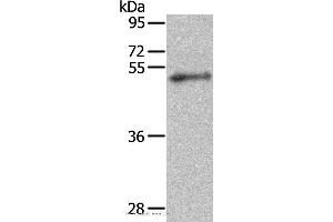 Western blot analysis of Mouse kidney tissue, using FOXP3 Polyclonal Antibody at dilution of 1:222 (FOXP3 antibody)
