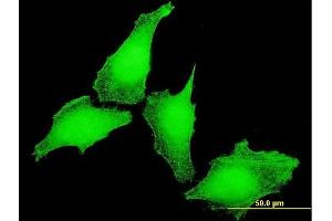 Immunofluorescence of monoclonal antibody to KCNIP4 on HeLa cell. (KCNIP4 antibody  (AA 1-250))