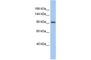Human Muscle; WB Suggested Anti-ZNF295 Antibody Titration: 0. (ZNF295 antibody  (N-Term))