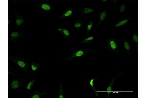 Immunofluorescence of purified MaxPab antibody to ZNF582 on HeLa cell. (ZNF582 antibody  (AA 1-517))