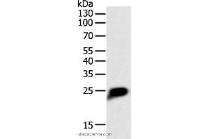 Western blot analysis of Human liver cancer tissue, using CRP Polyclonal Antibody at dilution of 1:1400 (CRP antibody)
