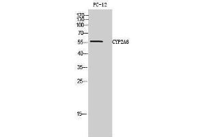 Western Blotting (WB) image for anti-Cytochrome P450, Family 2, Subfamily A, Polypeptide 6 (CYP2A6) (N-Term) antibody (ABIN3184173) (CYP2A6 antibody  (N-Term))