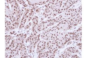 IHC-P Image Immunohistochemical analysis of paraffin-embedded Cal27 xenograft, using MST1, antibody at 1:500 dilution. (STK4 antibody  (C-Term))