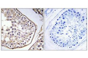Immunohistochemistry (IHC) image for anti-B Melanoma Antigen Family, Member 3 (BAGE3) (Internal Region) antibody (ABIN1850876) (BAGE3 antibody  (Internal Region))