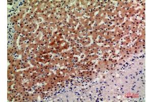 Immunohistochemistry (IHC) analysis of paraffin-embedded Human Liver, antibody was diluted at 1:200. (ACER2 antibody)