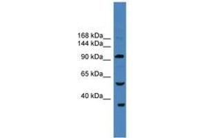 Image no. 1 for anti-Ubiquitin Specific Peptidase 29 (USP29) (AA 181-230) antibody (ABIN6745286)