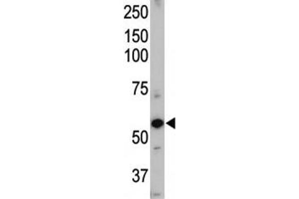 ACVRL1 antibody  (AA 38-68)