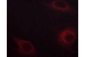 Immunofluorescence (fixed cells) (IF/ICC) image for anti-Nuclear Factor of kappa Light Polypeptide Gene Enhancer in B-Cells Inhibitor, epsilon (NFKBIE) (pSer161) antibody (ABIN6255101)