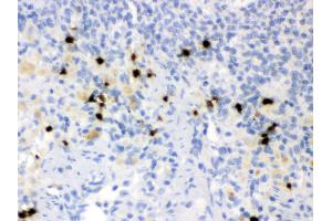 Immunohistochemistry (IHC) image for anti-Lipocalin 2 (LCN2) (AA 21-200) antibody (ABIN3043290)