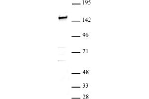 SMARCC1 / BAF155 antibody (pAb) tested by Western blot. (SMARCC1 antibody  (N-Term))