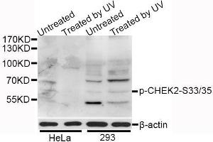 Western blot analysis of extracts of HeLa and 293 cells, using Phospho-CHEK2-S33/35 antibody (ABIN5995607) at 1/1000 dilution. (CHEK2 antibody  (pSer33, pSer35))