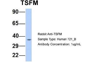 Host: Rabbit Target Name: TSFM Sample Type: Human 721_B Antibody Dilution: 1. (TSFM antibody  (Middle Region))