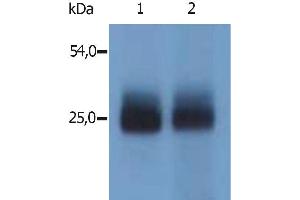 Western Blotting immunostaining with polyclonal anti-mouse NTAL antibody (specific for N-terminal domain of mouse NTAL) (LAT2 antibody  (Cytoplasmic Domain))
