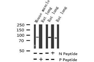 Western blot analysis of Phospho-CD44 (Ser706) expression in various lysates (CD44 antibody  (pSer706))