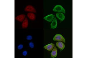 ABIN6256539 and ABIN6274072 staining Hela cells(45 min of heat-shock) by IF/ICC. (CDKN1C antibody  (pThr310))