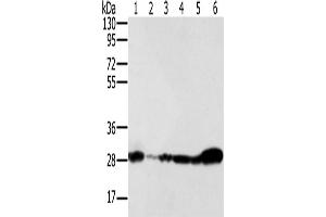 Western Blotting (WB) image for anti-NADH Dehydrogenase (Ubiquinone) Fe-S Protein 3, 30kDa (NADH-Coenzyme Q Reductase) (NDUFS3) antibody (ABIN2430525) (NDUFS3 antibody)