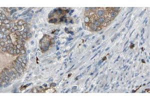 ABIN6276960 at 1/100 staining Human prostate tissue by IHC-P. (TNNC1 antibody  (Internal Region))